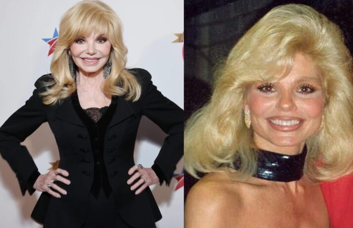Loni Anderson Cause Of Death